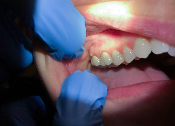 Best Emergency Treatment for Jaw Pain or Injury in Baywood Park, CA