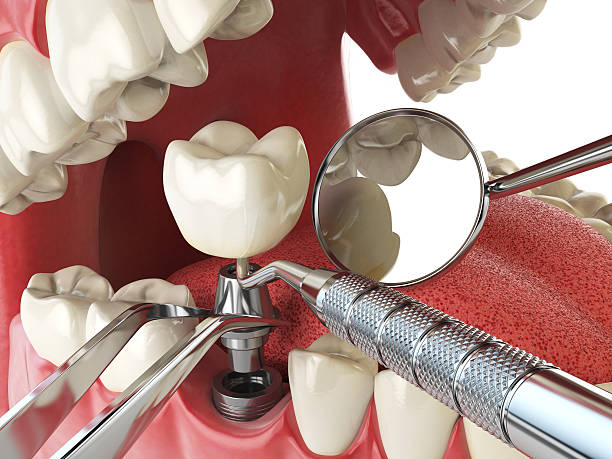 Best Emergency Care for Gum Disease in Baywood Park, CA